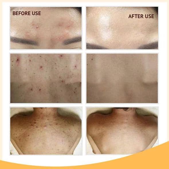 Zestaw serum rozjaśniającego Retinol C+ - Image 10