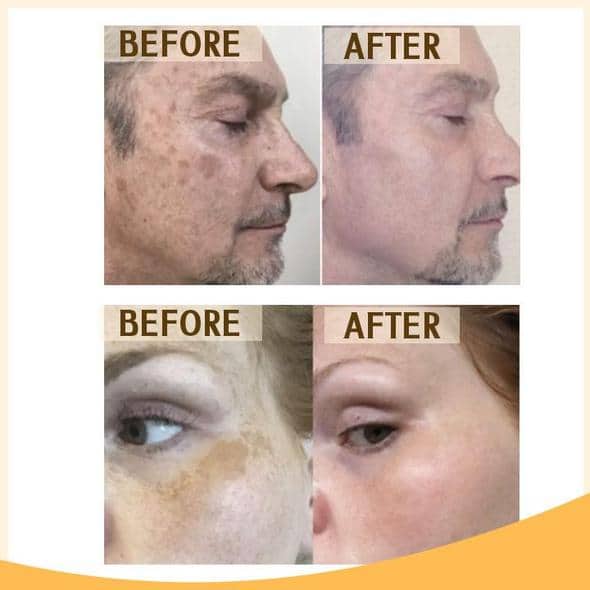 Zestaw serum rozjaśniającego Retinol C+ - Image 11