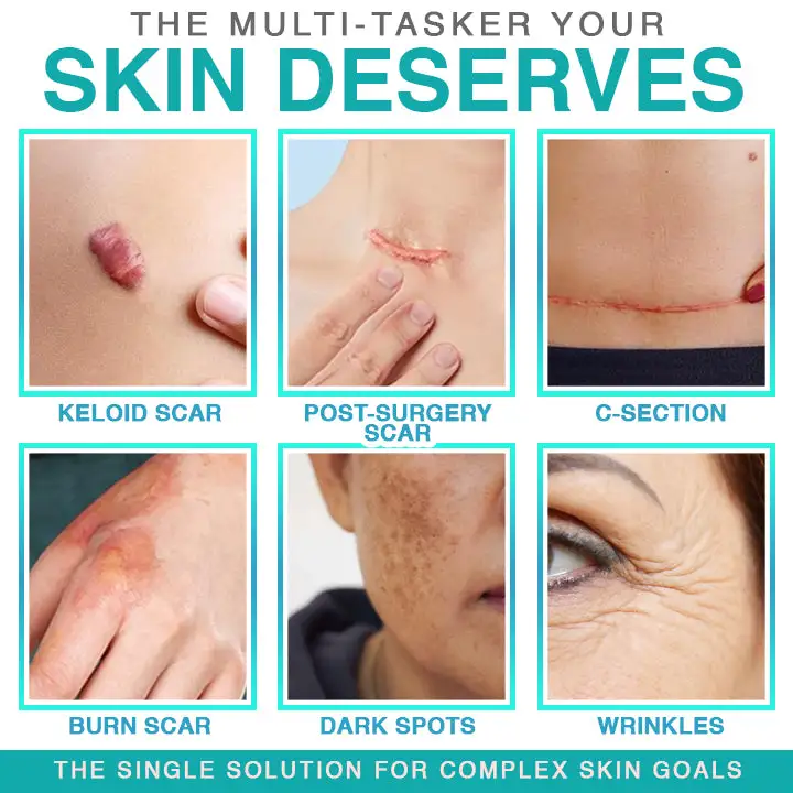 𝗖𝗮𝗿𝗲𝗕𝗿𝗲𝗲𝘇𝗲® Plaster pielęgnacyjny z mikroigłami 3 w 1 - Image 2