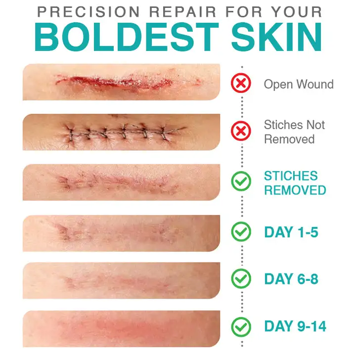 𝗖𝗮𝗿𝗲𝗕𝗿𝗲𝗲𝘇𝗲® Plaster pielęgnacyjny z mikroigłami 3 w 1 - Image 4