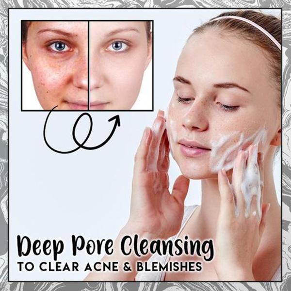 Mydło w kostce usuwające cellulit z popiołem wulkanicznym - Image 5