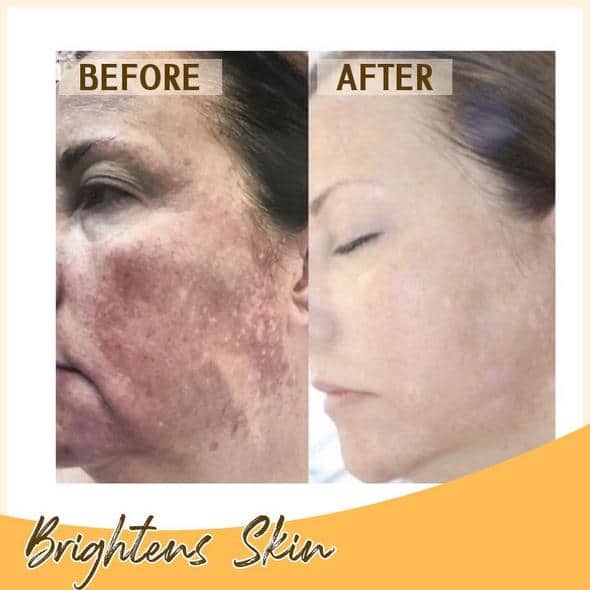 Zestaw serum rozjaśniającego Retinol C+ - Image 6