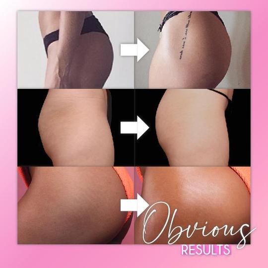 Unosząca naszywka kształtująca Bootie - Image 6