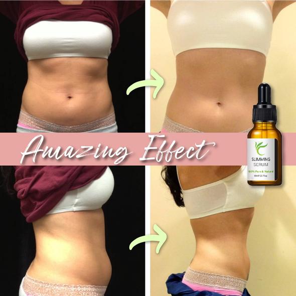 Pas do plastyki brzucha z serum na spalanie tłuszczu - Image 7