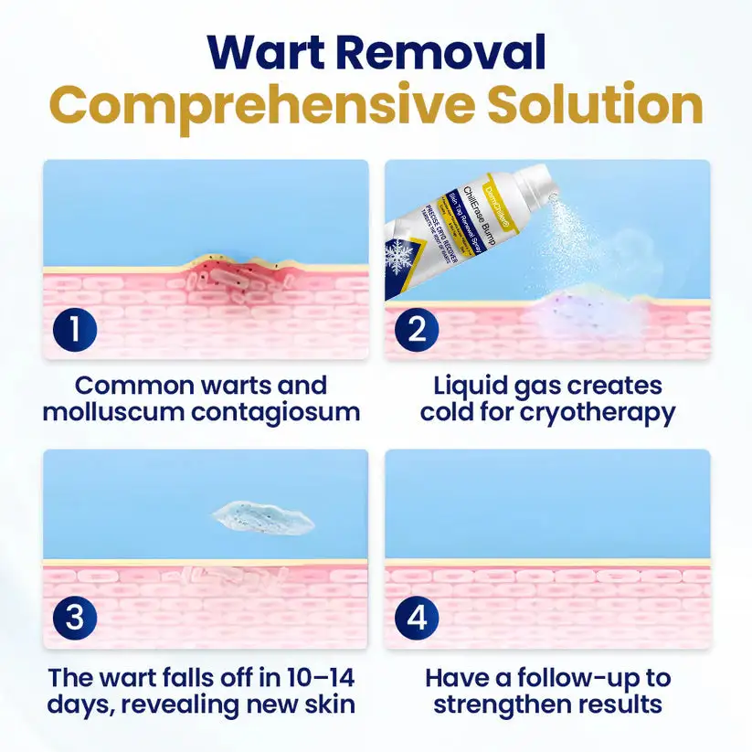 DermChiller® ChillErase Spray odnawiający guzki i znamiona skórne - Image 4