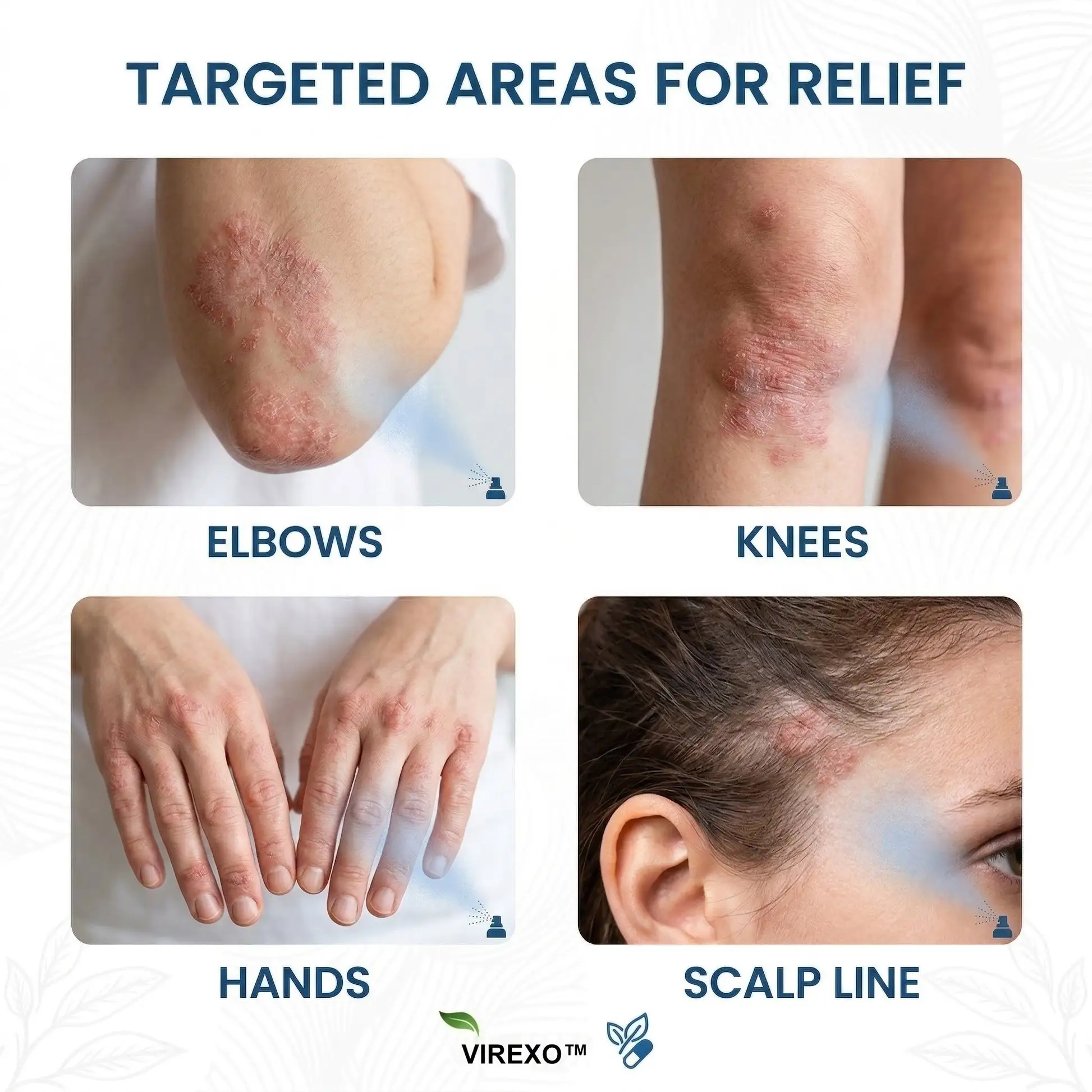 Botaniczny spray z magnezem Virexo™ - Image 2