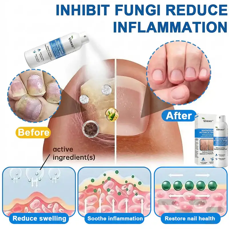 Botaniczny spray z magnezem Virexo™ - Image 4