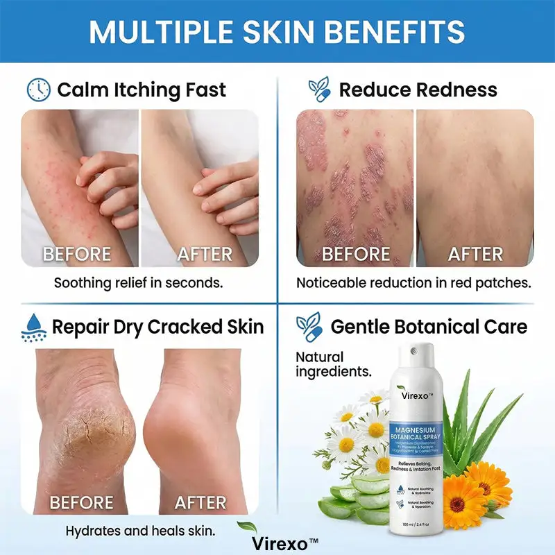 Botaniczny spray z magnezem Virexo™ - Image 9