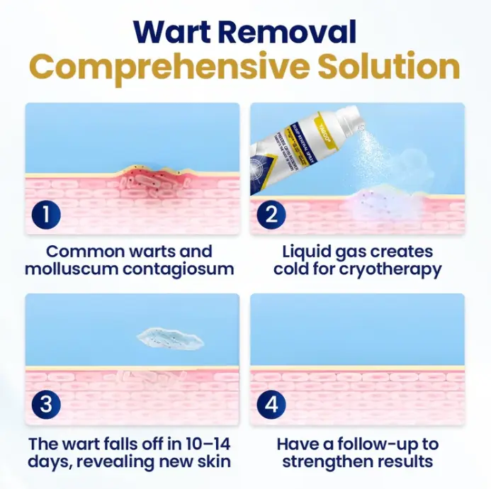 Yagoo® Chillique Spray odnawiający guzki - Image 3