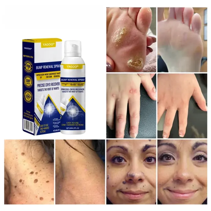 Yagoo® Chillique Spray odnawiający guzki - Image 5